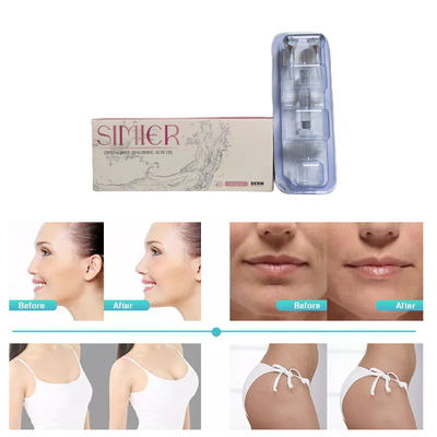 2ml Cross Linked Dermal Filler High Ha Concentration 24mg/Ml Anti Wrinkles