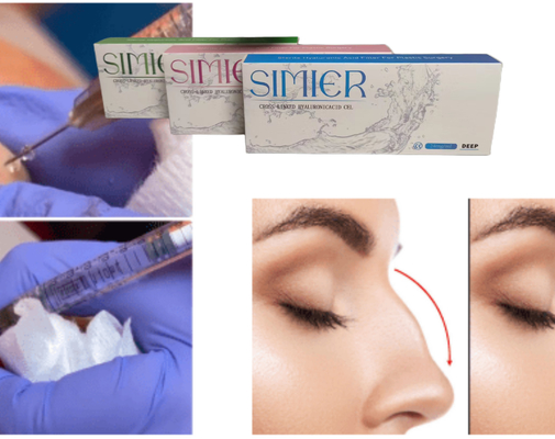 Transparent 10ml Sodium Hyaluronate Gel Injection Treatment For Filling Smile Lines