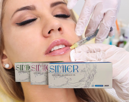 Cross Linked 5ml 30mg/Ml Chin Hyaluronic Acid Injection Anti Wrinkle