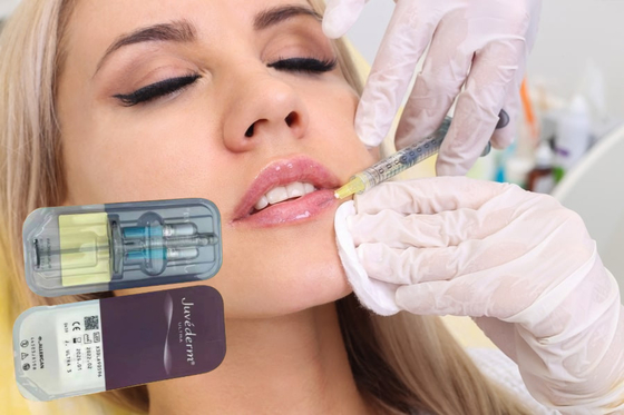 Fillers Hyaluronic Acid Gel 5ml Lip Dermal Filler Injections Injectable Dermal Filler