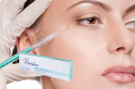 27G Marionette Lines Hyaluronic Acid Filler 1ml Deep Line Fillers With Lido