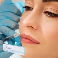 Hyaluronic Acid Injectable Dermal Filler Injectable Gel For Lips