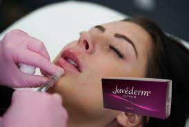 1ml / Box Injectable Lip Fillers Chin cheeks Cross Linked HA Filler