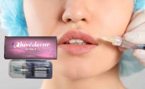 1ml / Box Injectable Lip Fillers Chin cheeks Cross Linked HA Filler
