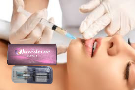 Face Nose Hyaluronic Acid Lip Fillers Juvederm Ultra 4 24mg/Ml