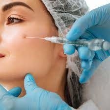 Smooth Wrinkles Injectable Dermal Filler Acid Hialuronic Juvederm Ultra 3	2*1ml